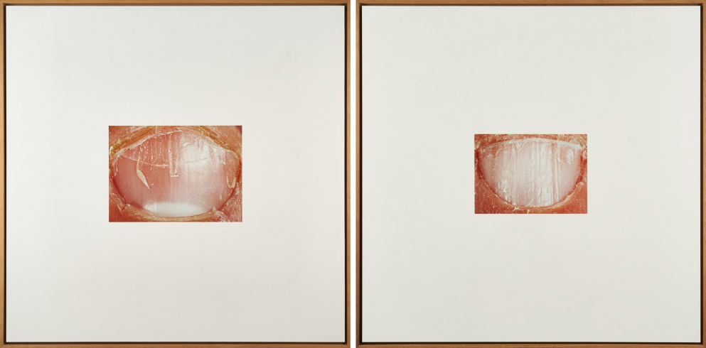 Patrick Tosani,"Ongle n° 6" ["Nail n° 6"] and "Ongle n° 17" ["Nail n° 17"], 1990 from the "Nails" series