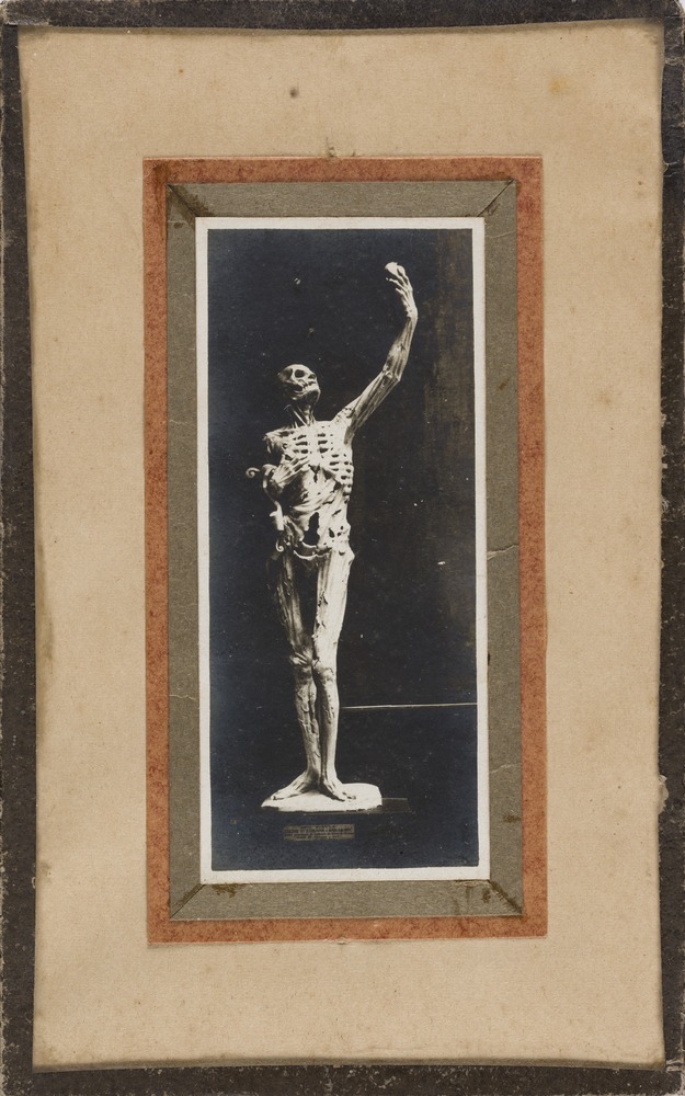 Le "Transi de René de Chalon", de Ligier Richier